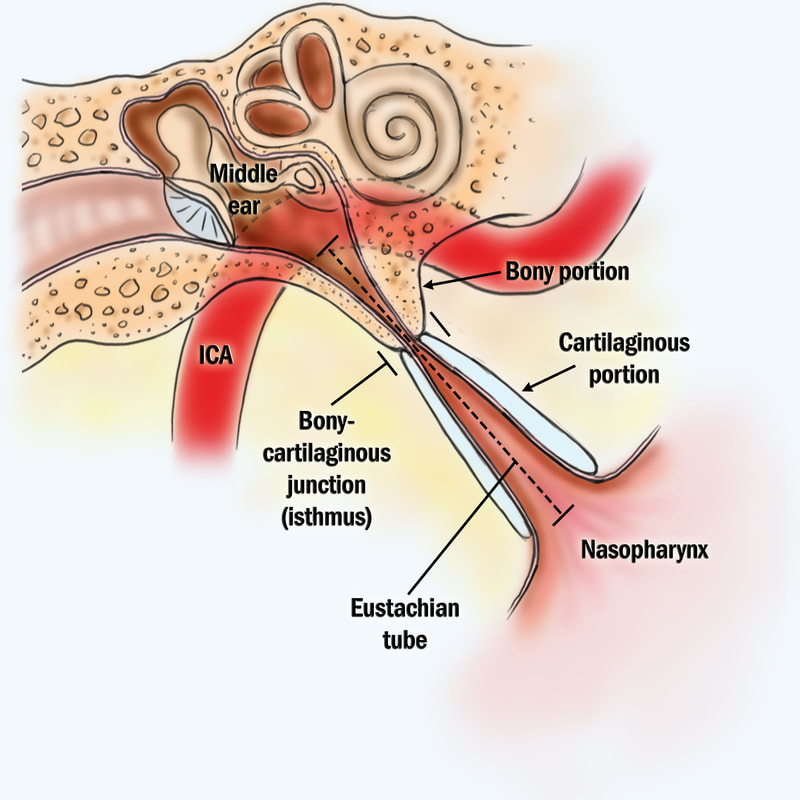 Signs of Nasal Polyps - Georgetown Ear, Nose and Throat Center P.A.